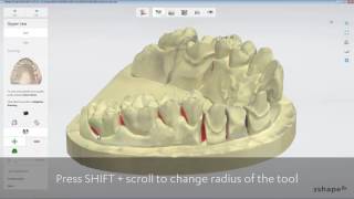 3Shape Dental System  Adaptive Scanning [upl. by Laden915]