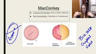 Mystery Diagnosis on Primary Immunodeficiency [upl. by Martguerita870]