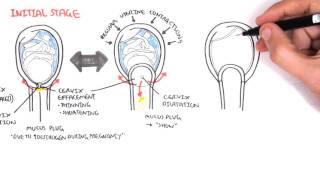 Obstetrics  Stage I of Labour [upl. by Nahtanha212]