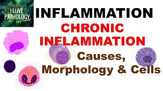 INFLAMMATION 8 CHRONIC INFLAMMATION Causes Morphology amp Cells [upl. by Ilamad]