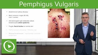 Pemphigus Vulgaris – Dermatology  Lecturio [upl. by Ferriter256]