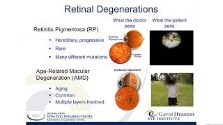 A Stem CellBased Therapy for Retinitis Pigmentosa [upl. by Augy]