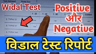 Widal Test Widal Test Positive Widal Test In Hindi Widal Test Report विडाल टेस्टWidaltestkaise [upl. by Shannah]