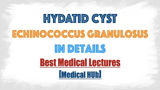 Hydatid cyst of Echinococcus granulosusDog tapeworm  Discussed in details everything you need [upl. by Omidyar740]