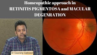 Homeopathic approach in RETINITIS PIGMENTOSA and MACULAR DEGENERATION Dr Gaurang Gaikwad [upl. by Letsyrhc681]