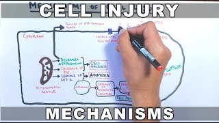 Lecture 33 Ischemia reperfusion injury [upl. by Danforth261]