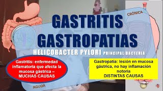 GASTRITIS y GASTROPATÍA [upl. by Atteynod]