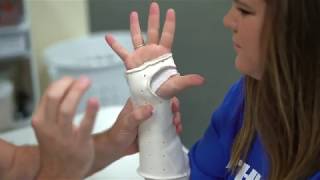 Carpal vs Cubital Tunnel Syndrome [upl. by Rosenblast]