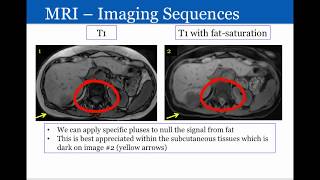 Introduction to Radiology Magnetic Resonance Imaging [upl. by Nageet]