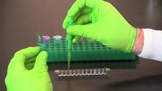 How To Perform A Qualitative ELISA [upl. by Dorisa]