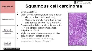 Pathology of Stage IV Lung Adenocarcinoma [upl. by Sklar]