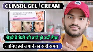 Clinsol gel how to use full review in hindi [upl. by Bithia787]