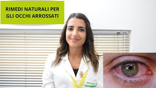 RIMEDI NATURALI PER GLI OCCHI ARROSSATI  Farmacia De Florio [upl. by Calondra]