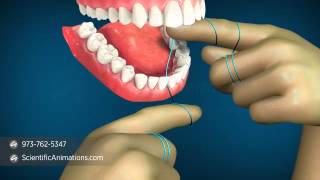 How to Floss Properly  Flossing Technique [upl. by Uda]