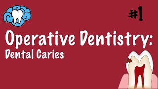 Operative Dentistry  Dental Caries  INBDE ADAT [upl. by Kimberlee]