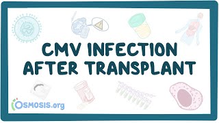 CMV infection after transplant [upl. by Val]