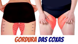 6 Exercícios Fáceis Para Perder Gordura da Coxa em 4 Semanas [upl. by Onfre522]