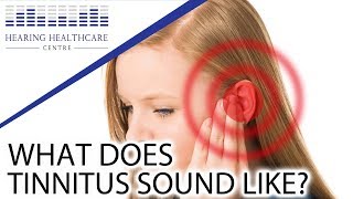 What Does Tinnitus Sound Like [upl. by Bremble109]