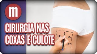 Cirurgia plástica nas coxas e culote  Mulheres 070717 [upl. by Anircam604]