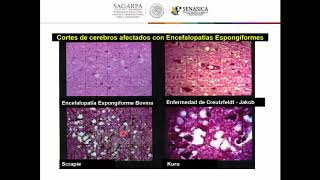 Encefalopatía Espongiforme Bovina [upl. by Eipper]