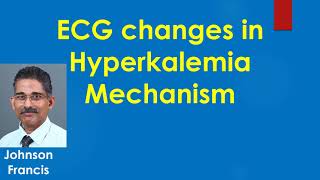 ECG changes in Hyperkalemia  Mechanism [upl. by Burra227]