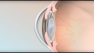 Extraocular Muscles  Eye Anatomy [upl. by Rotceh]