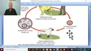 Hepatic disorders in Arabic 10  Hydatid cyst of the liver  by Dr Wahdan [upl. by Johppah767]