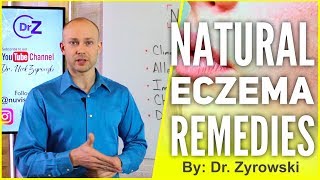 Natural Eczema Remedies  Actually Works [upl. by Chiles]