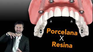 Implante Dentário Porcelana ou Resina [upl. by Artemahs736]