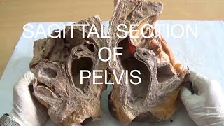 SAGITTAL SECTION OF PELVIS  DEMONSTRATION  ANATOMY [upl. by Selima]