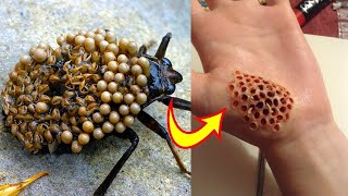 Top 10 Insectos Y Arácnidos Más Peligrosos Del Mundo [upl. by Acissj]