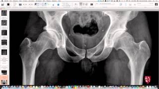 SAGITTAL SECTION OF PELVIS  DEMONSTRATION  ANATOMY [upl. by Yrrol]