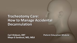 Tracheostomy TOM Valve Placement and Removal [upl. by Oirifrop]