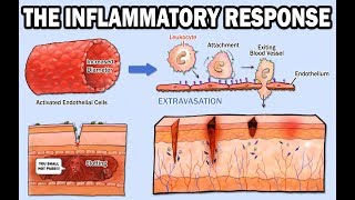 THE INFLAMMATORY RESPONSE [upl. by Annaiv831]