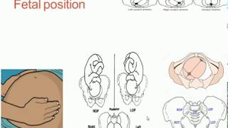 Fetal lie presentation and position [upl. by Nirok]