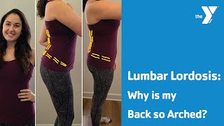 Lumbar Lordosis Why is my Back so Arched [upl. by Tala]