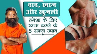 दाद खाज खुजली हमेशा के लिए खत्म करने के 5 सफल उपाय  Swami Ramdev [upl. by Seavey960]