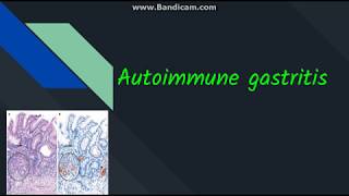 Autoimmune gastritis [upl. by Nylodnew463]