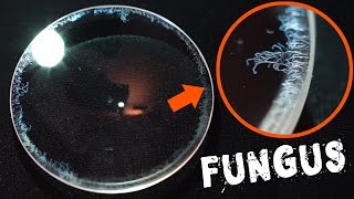 How to Remove Fungus from a Camera Lens FAST amp EASY [upl. by Nohsad]