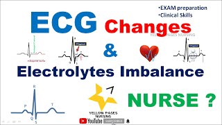 ECG changes in electrolyte imbalance [upl. by Aerdnad585]