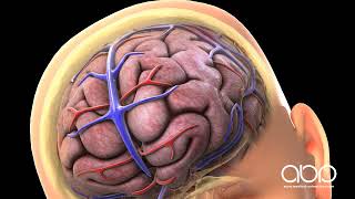 Concussion and Bleeding On The Brain [upl. by Porett]