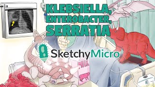 Klebsiella Enterobacter Serratia  SketchyMicro  Sketchy Medical USMLE Step 1 [upl. by Anali]