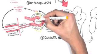 Chronic Kidney Disease CKD Pathophysiology [upl. by Rocker]