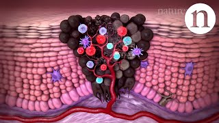 Tumour immunology and immunotherapy [upl. by Trebleda]