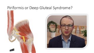 Piriformis Syndrome or Deep Gluteal Syndrome [upl. by Celeste]