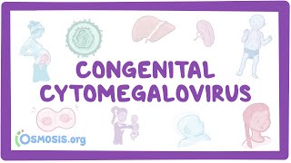 Congenital CMV  causes symptoms diagnosis treatment pathology [upl. by Hammel]