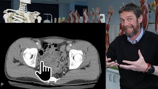 Pelvic Floor Part 1  The Pelvic Diaphragm  3D Anatomy Tutorial [upl. by Verger653]