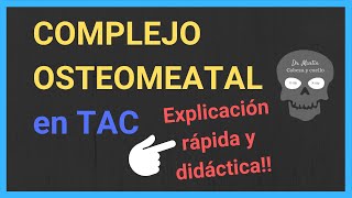 COMPLEJO OSTEOMEATAL ➡️ TAC [upl. by Eckblad]