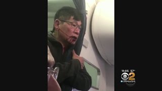 United Settles With Dr David Dao [upl. by Adham572]