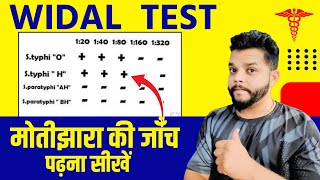 Widal Test कैसे समझे  How To Read Widal Test Report  Typhoid Blood Test [upl. by Dorlisa474]